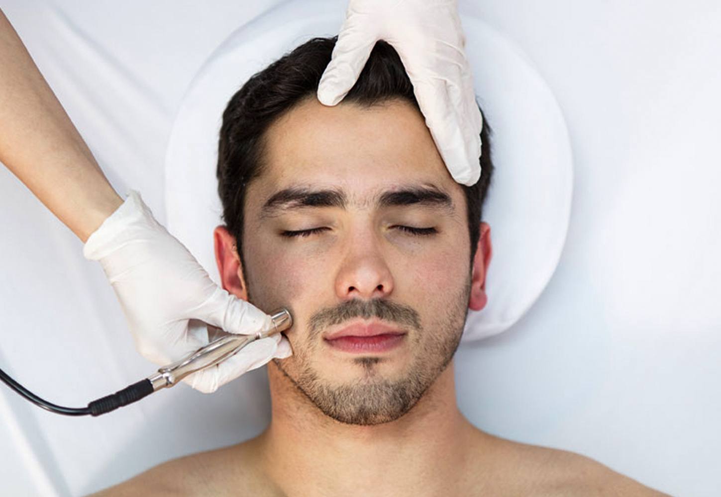 Chemical Peels procedure