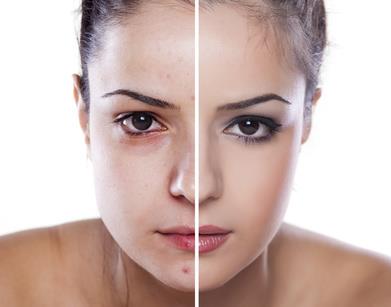 Laser Therapy procedure - Gallery image 5