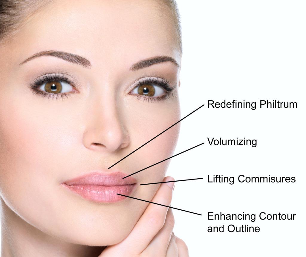 Facial Fillers procedure - Gallery image 1