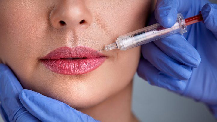 Lip Fillers procedure