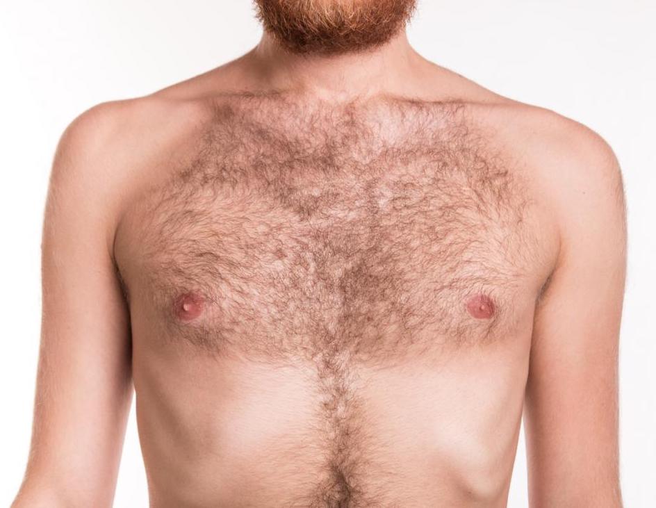 Male Breast Reduction procedure