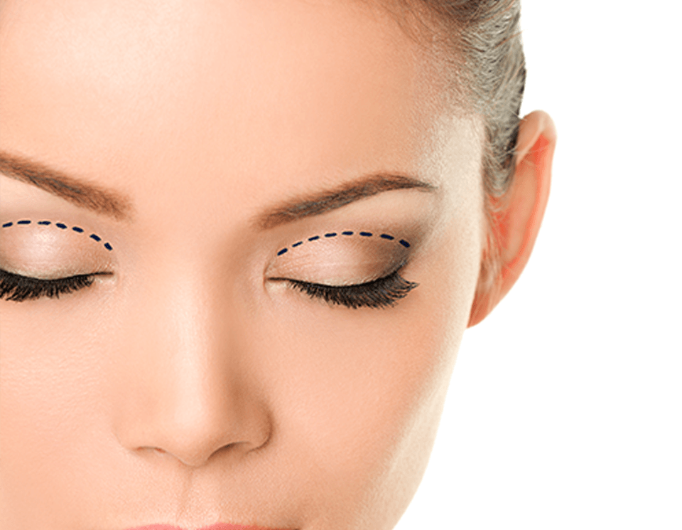 Facelift Pre & Post-Operative Instructions